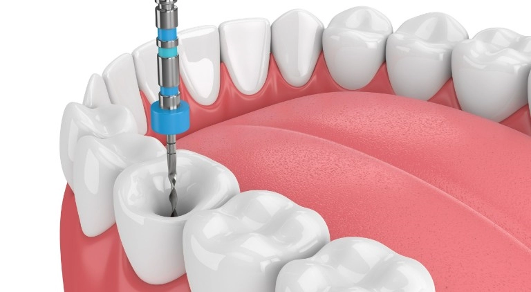 Endodoncja