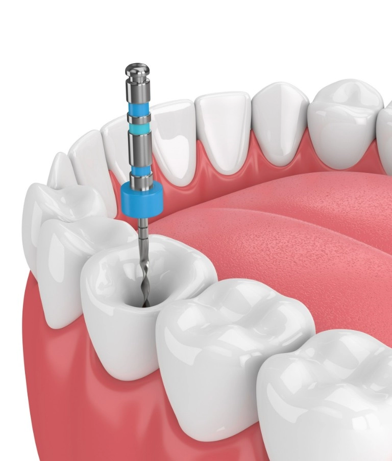 Endodoncja